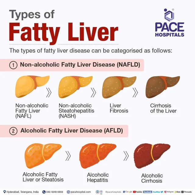 nafld