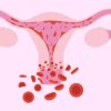 خونریزی قاعدگی